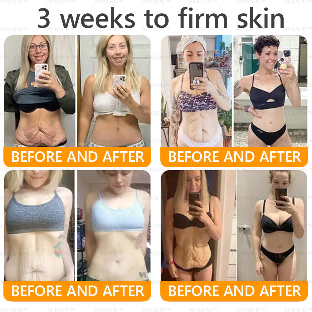 Made and Shipped from USA ✨ LBMLBM™ Bee venom Comprehensive Cream 🔥 LAST DAY 80% OFF 💎💎