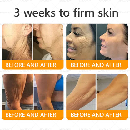 Made and Shipped from USA ✨ LBMLBM™ Bee venom Comprehensive Cream 🔥 LAST DAY 80% OFF 💎💎