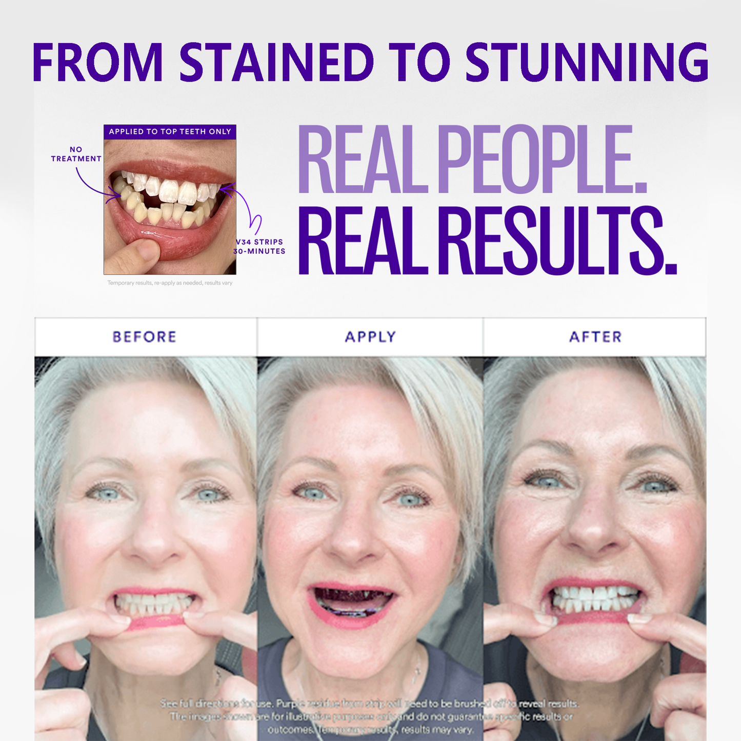 Clinclii™ V36 Whitening Strips – Professional Teeth Whitening at Home