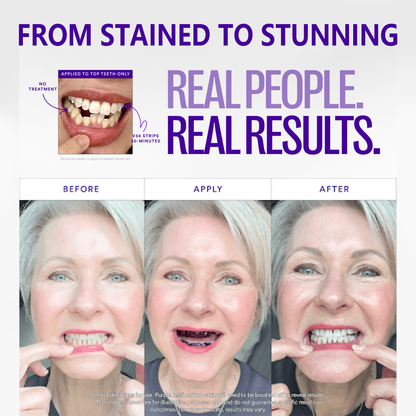 Clinclii™ V36 Whitening Strips – Professional Teeth Whitening at Home