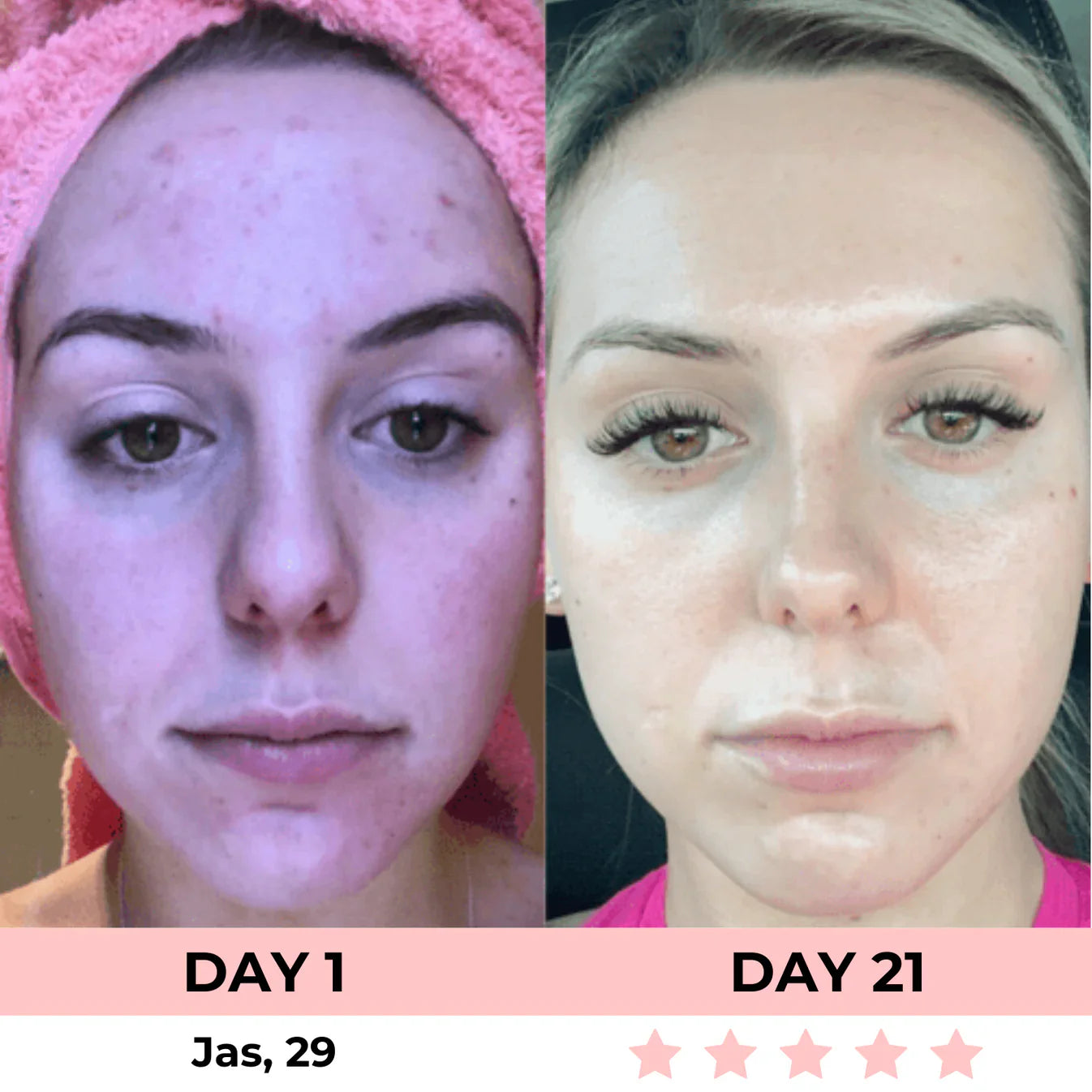 60% OFF + FREE SHIPPING🔥CYBER MONDAY SALE ENDS TONIGHT💝AURORA 7-in-1 LED Facial Sculptor