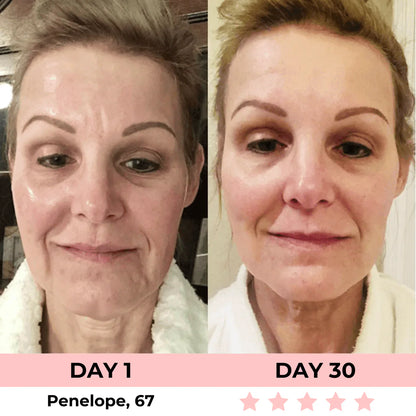 60% OFF + FREE SHIPPING🔥CYBER MONDAY SALE ENDS TONIGHT💝AURORA 7-in-1 LED Facial Sculptor