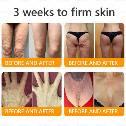 Made and Shipped from USA ✨ LBMLBM™ Bee venom Comprehensive Cream 🔥 LAST DAY 80% OFF 💎💎