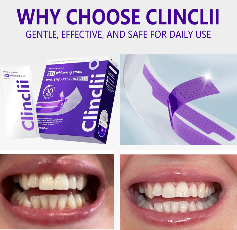 Clinclii™ V36 Whitening Strips – Professional Teeth Whitening at Home