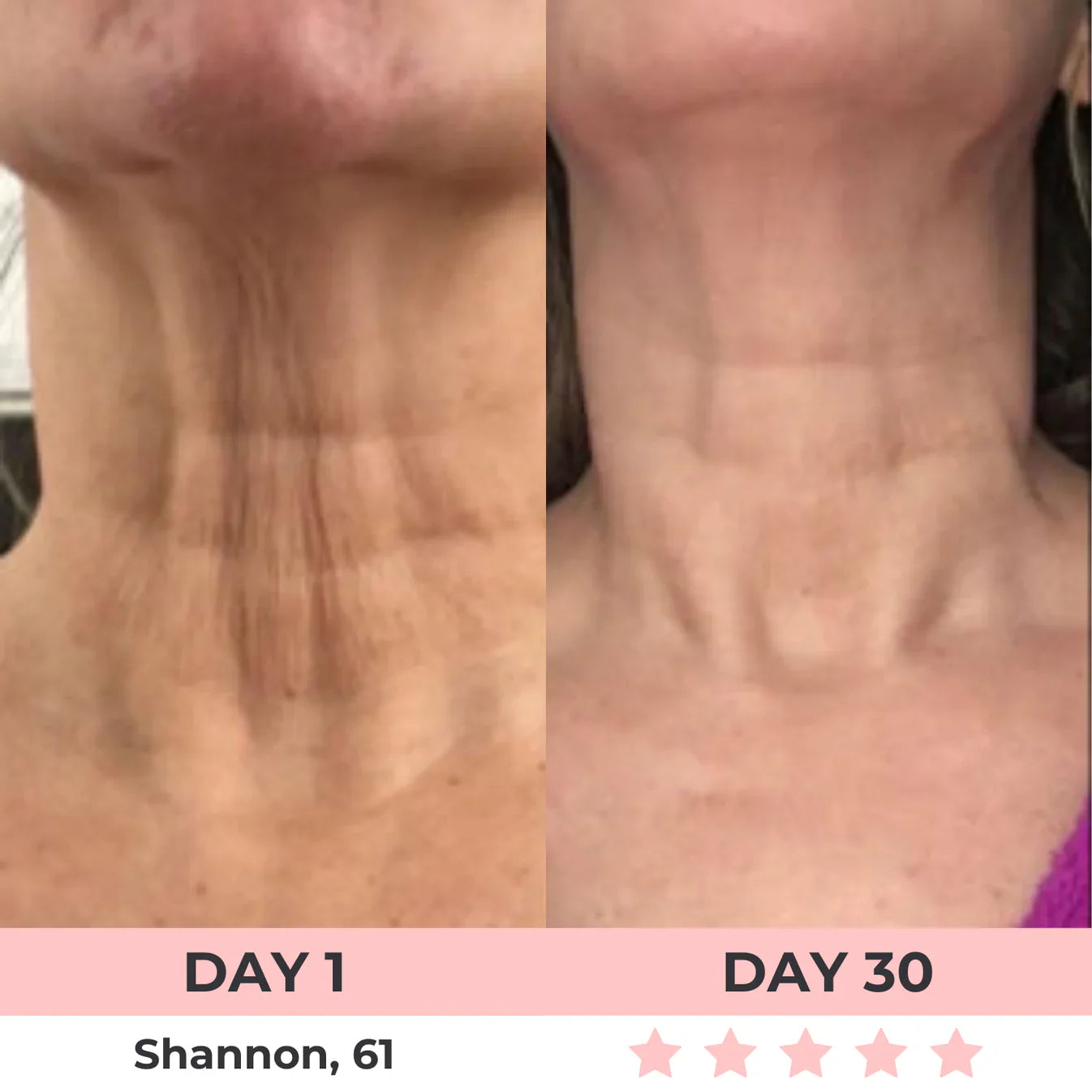 60% OFF + FREE SHIPPING🔥CYBER MONDAY SALE ENDS TONIGHT💝AURORA 7-in-1 LED Facial Sculptor