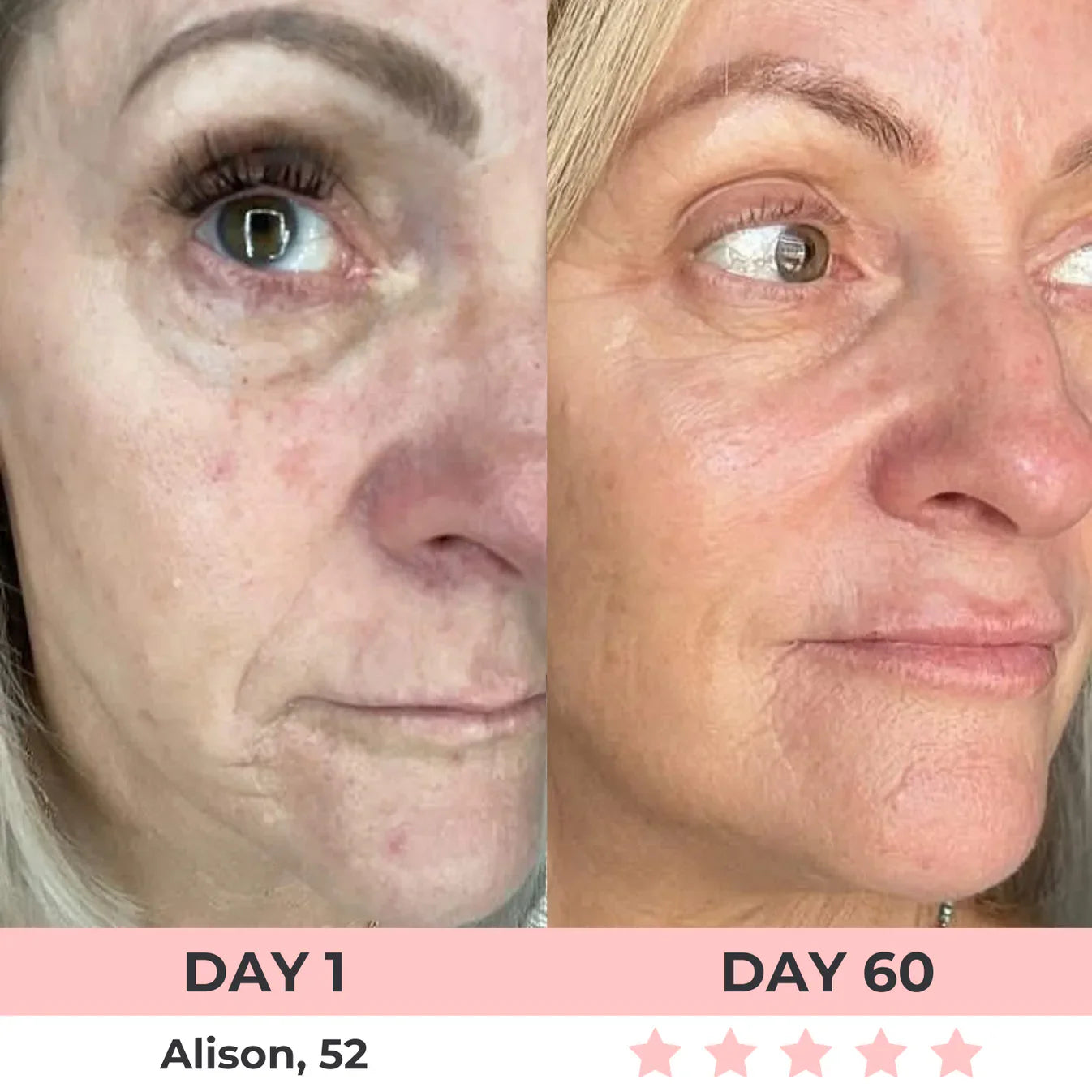 60% OFF + FREE SHIPPING🔥CYBER MONDAY SALE ENDS TONIGHT💝AURORA 7-in-1 LED Facial Sculptor