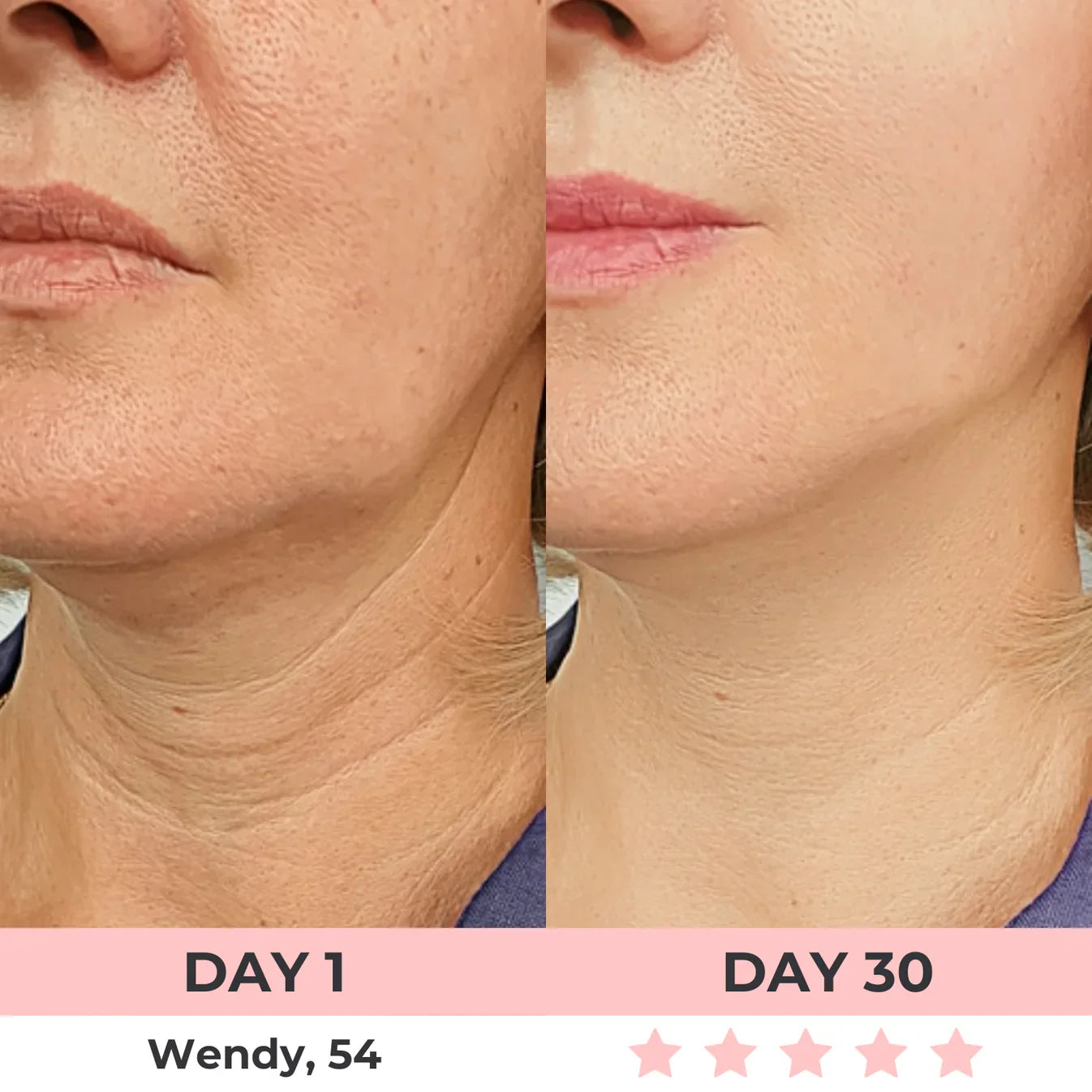 60% OFF + FREE SHIPPING🔥CYBER MONDAY SALE ENDS TONIGHT💝AURORA 7-in-1 LED Facial Sculptor