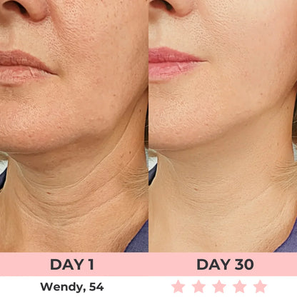 60% OFF + FREE SHIPPING🔥CYBER MONDAY SALE ENDS TONIGHT💝AURORA 7-in-1 LED Facial Sculptor